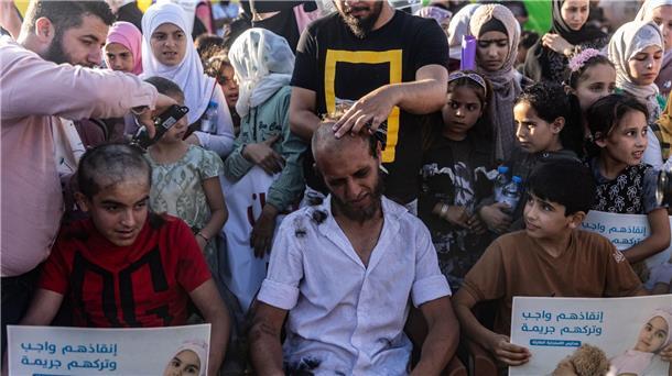 Aus Solidarität mit Krebspatienten lassen sich einige Demonstranten den Kopf rasieren.