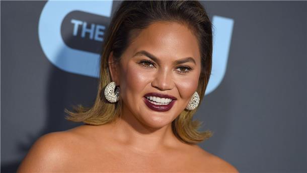 Chrissy Teigen über Buccal Fat Removal: „Ja, ich habe es getan, na und?“
