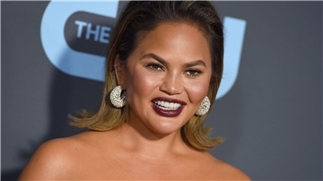 Chrissy Teigen über Buccal Fat Removal: „Ja, ich habe es getan, na und?“