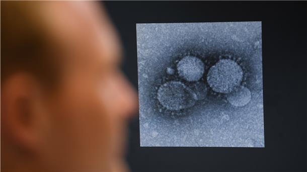 Coronavirus: Impfstoff-Entwicklung braucht vermutlich Monate Das Coronavirus beschäftigt auch hessische Wissenschaftler. Die Virologen der Uni Marburg sind an der Entwicklung eines Impfstoffs gegen den Lungen-Erreger beteiligt.