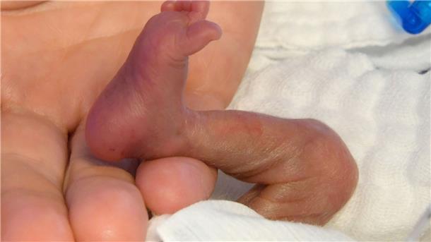 Der direkte Hautkontakt von Frühchen und Mutter bzw. Betreuungsperson noch vor dem Brutkasten, kann einen positiven Einfluss auf die Entwicklung der Kinder haben.