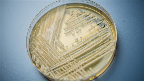 Krankenhaus-Pilz ist weit verbreitet - auch in Deutschland Der Hefepilz Candidozyma auris (früher bekannt als Candida auris).