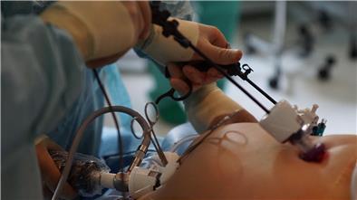 Der minimalinvasive Eingriff: Mit einem Trokar (links), einem Arbeitskanal, wird im Nabelbereich ein Zugang zum Bauchraum geschaffen. Hiermit wird Luft in den Bauch geblasen, damit der Chirurg Platz zum Operieren hat. Über zwei weitere Arbeitstrokare (rechts im Bild) kann der Operateur Miniinstrumente in den Unter- oder Oberbauch einführen.