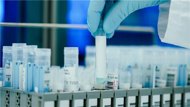 RKI registriert 175 Corona-Tote innerhalb eines Tages Die Gesundheitsämter in Deutschland meldeten dem RKI zuletzt 38.668 Corona-Neuinfektionen.