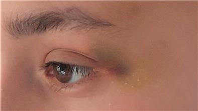 Blaues Auge