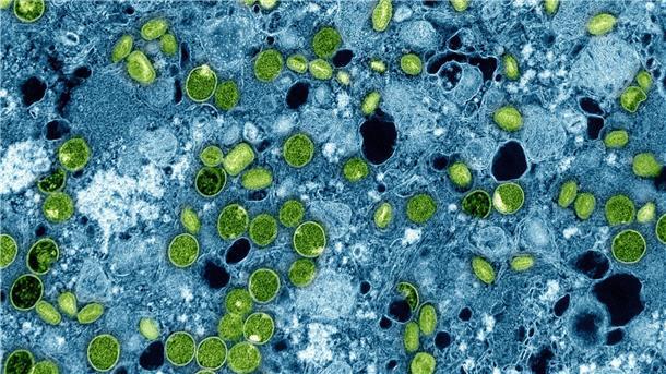 Lauterbach: Mpox derzeit kein flächendeckendes Problem Diese kolorierte elektronenmikroskopische Aufnahme aus dem Jahr 2024 zeigt Mpox-Viruspartikel (grün). (Archivbild)