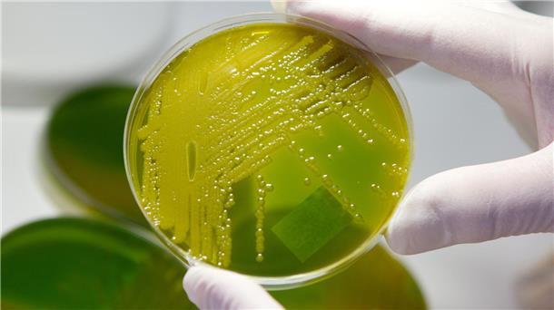 Häufung von Ehec-Infektionen - wie gefährlich ist das? Ehec steht für enterohämorrhagische Escherichia coli und bezeichnet bestimmte krankmachende Stämme des Darm-Bakteriums, die vor allem bei Wiederkäuern wie Rindern vorkommen. (Archivbild)