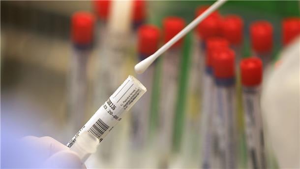 Corona-Lage in Niedersachsen verschärft sich weiter Ein Abstrich wird in einem Labor auf das Coronavirus untersucht.