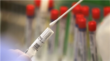 Ein Abstrich wird in einem Labor auf das Coronavirus untersucht.
