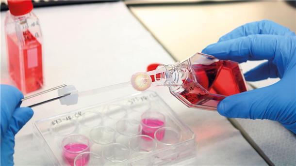 Mehr Gewebespenden - aber weiterhin Mangel an Herzklappen Ein Augenhornhaut-Transplantat wird von einem Labormitarbeitenden bearbeitet.