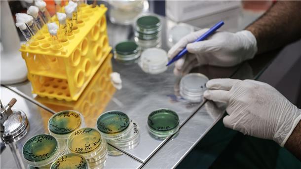 WHO besorgt über weltweit steigende Zahl von Cholerafällen Ein Labortechniker bearbeitet Proben von Choleraverdachtsfällen in einem medizinischen Labor.