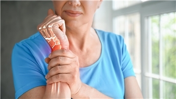 Ein leichter Sturz, eine unbedachte Bewegung und der Knochen hält nicht mehr. Dann ist die Osteoporose schon weit fortgeschritten.