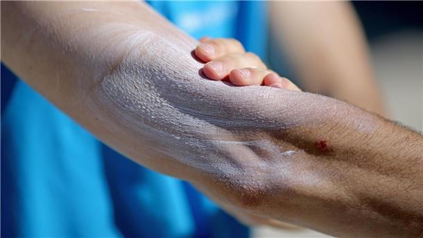 Ein Mann verreibt Sonnencreme auf seinem Arm. Einer aktuellen Umfrage zufolge nutzt gut ein Drittel aller Befragten im Frühjahr und Sommer normalerweise kein Sonnenschutzmittel.