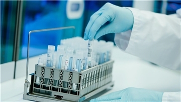 Ein Mitarbeiter hält in einem Coronatest-Labor der Limbach Gruppe PCR-Teströhrchen in den Händen. Die Zahl der im Labor bestätigten Corona-Fälle in Deutschland steigt wieder, allerdings auf relativ niedrigem Niveau.