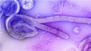 Eine elektronenmikroskopische Aufnahme des Marburgvirus.