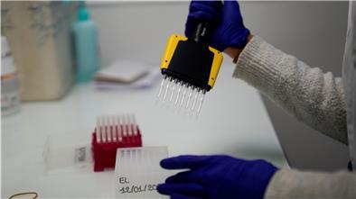 Eine Medizintechnikerin bereitet Proben vor, um sie auf eine hochansteckende Corona-Mutation zu untersuchen.