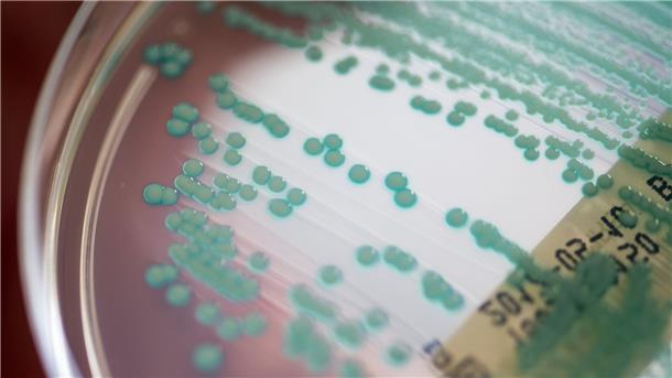 Pandemie ohne Ende: 35.000 Tote durch Antibiotikaresistenzen Eine Petrischale mit MRSA-Keimen, aufgenommen im Universitätsklinikum Regensburg.
