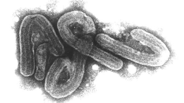 Elektronenmikroskopische Aufnahme des Marburg-Virus. Das Marburg-Virus gehört zu den gefährlichsten bekannten Krankheitserregern.