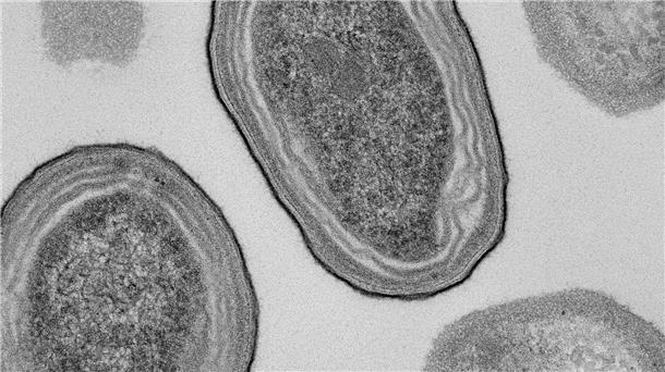 Klimakrise: Wohl häufigstem Organismus droht Extrem-Schwund Elektronenmikroskopische Aufnahme von Prochlorococcus-Zellen.