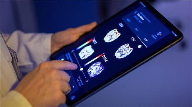 Gehirnbilder eines Patienten in einer KI-basierten App. Nach einer Deloitte-Umfrage sehen viele Bürgerinnen und Bürger den Einsatz von KI in der Medizin skeptisch, vor allem wenn es um die Therapie geht. (Symbolbild)
