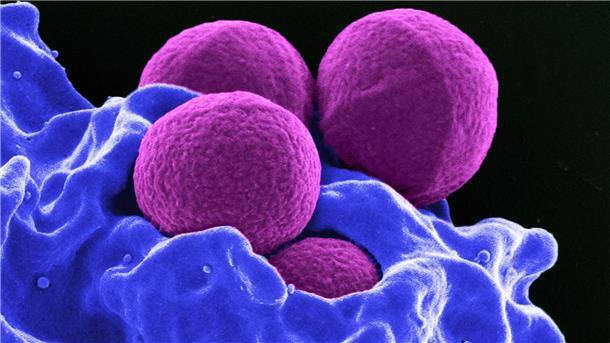 Datenanalyse: Antibiotika-Krise droht schlimmer zu werden Jede Anwendung kann zur Vermehrung resistenter Bakterien führen, da diese dann einen Überlebensvorteil haben. (Archivbild)