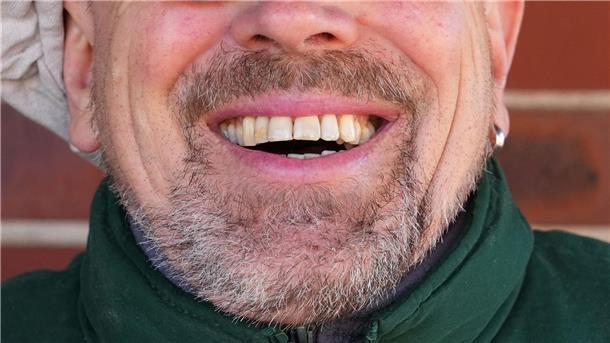 Forscherin: Lachen könnte sinnvoller Therapieansatz sein Könnte Lachen ein Therapieansatz werden?