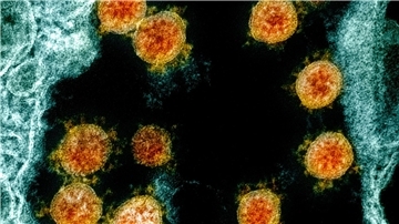 Partikel des Coronavirus SARS-CoV-2 wurden für eine elektronenmikroskopische Aufnahme am „National Institute of Allergy and Infectious Diseases Integrated Research Facility“ farblich bearbeitet.