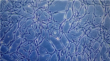 Proben kultivierter Fischzellen sind auf einem Monitor eines Mikroskops zu sehen. (Archivbild)