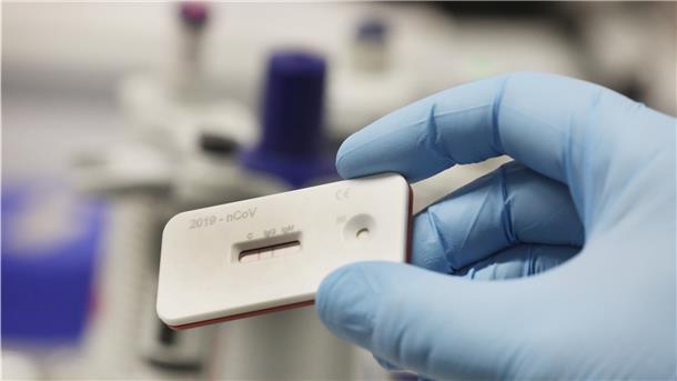 Pflegeheime aus der Region setzen auf Schnelltests So oder ähnlich sehen die Corona-Schnelltests aus. Zwei Streifen geben einen Hinweis auf eine Infektion mit dem Corona-Virus. Es geht relativ schnell und ohne Labor, doch der logistische Aufwand für die Pflegeheime ist groß.