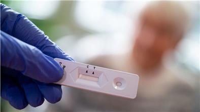 Wenn der Schnelltest positiv ist, dann folgt ein sogenannter PCR-Test.